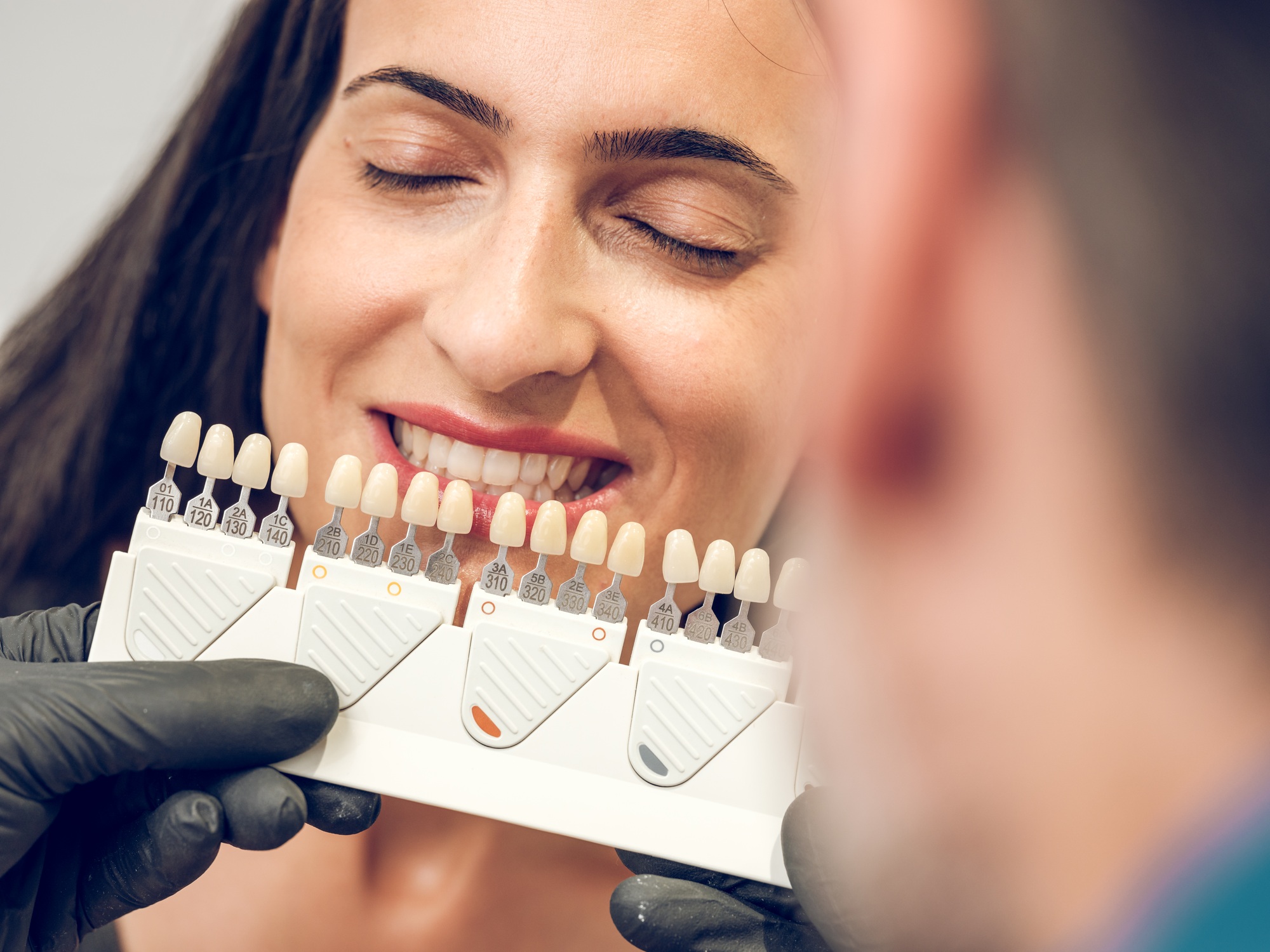 Dentist picking shade of implants for veneers for young woman