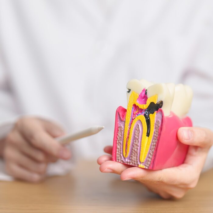Dentist with tooth Anatomy model. Oral Teeth decay